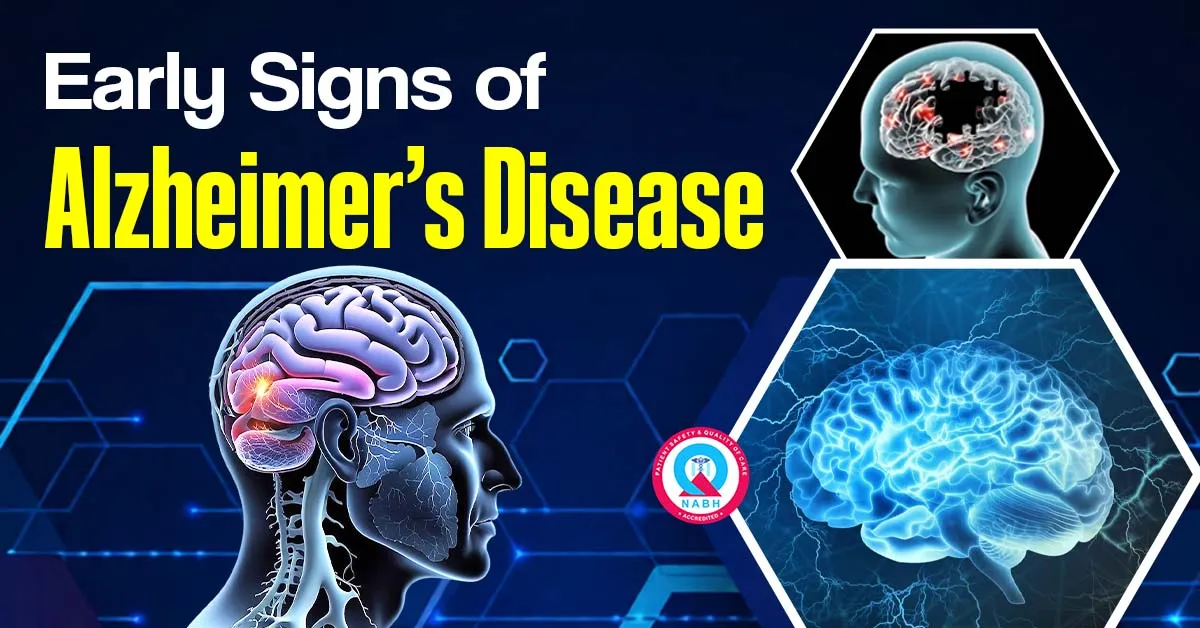 early-signs-of-alzheimer-disease